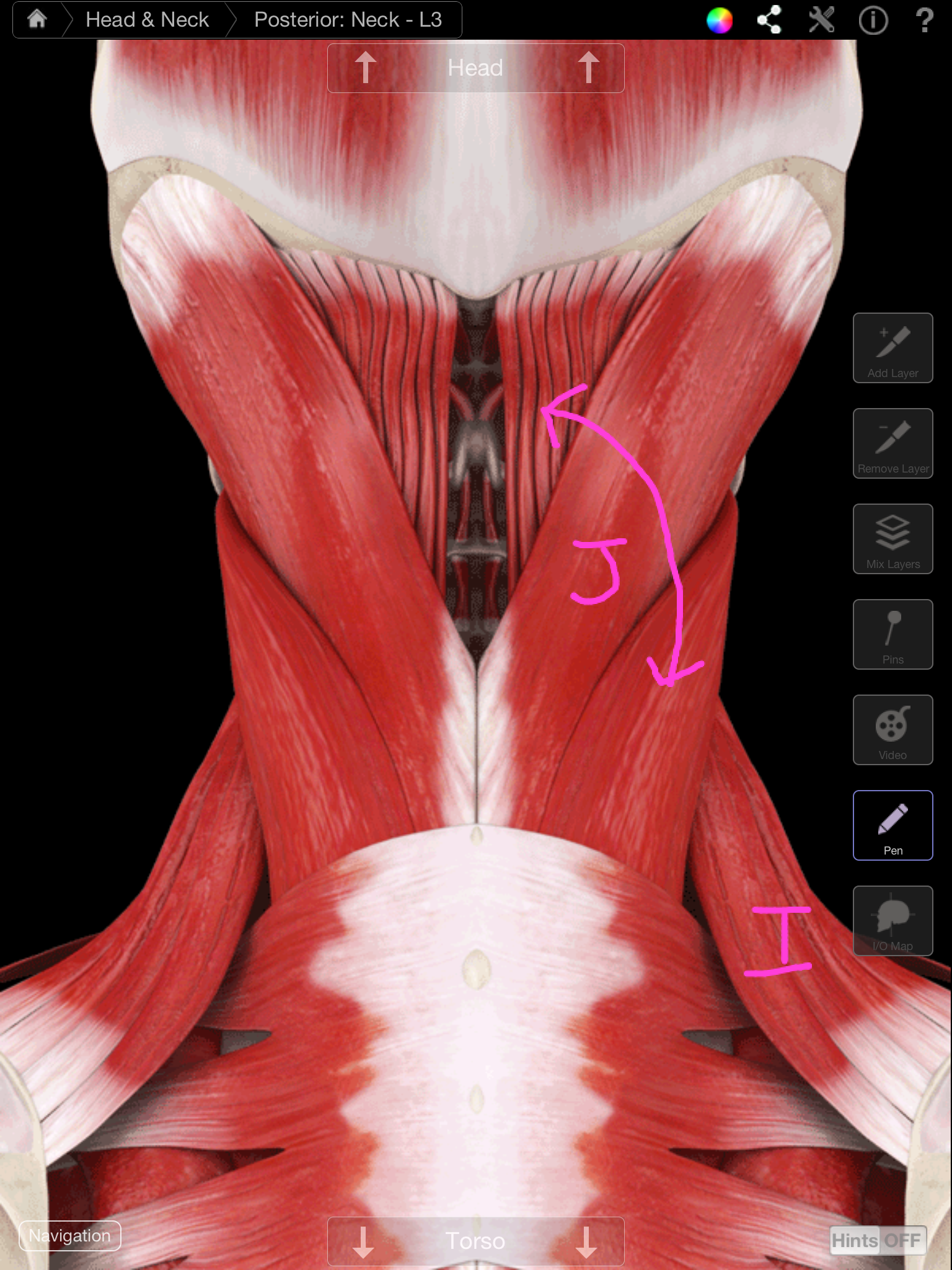 Cervical Spine Degeneration And Muscle Spasm 43